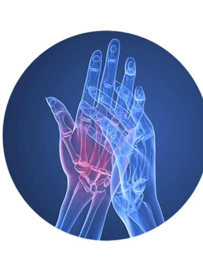 Arthritic Drugs