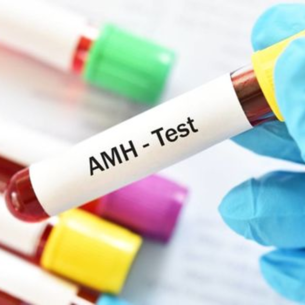 Anti Mullerin Hormone