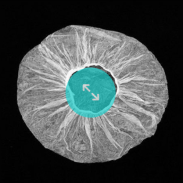 Sms Fabric Non Woven Disposable Surgical Cap, Size: 20 Inch